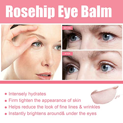 חידוש נוסף של רוזה עין, מזור עיניים קומפקטי אנטי-קמטים, מזרן עיניים לחות ומבהיר, קרם לתיקון עיניים, מקל קרם עיניים נגד