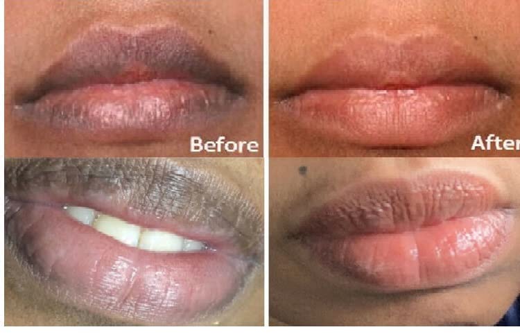 2 מחשב שפתיים טיפול של שפות ורוד טרי ברקים הלבנת קרם טיפול להסיר כהה עשן שפות שפתיים שמן